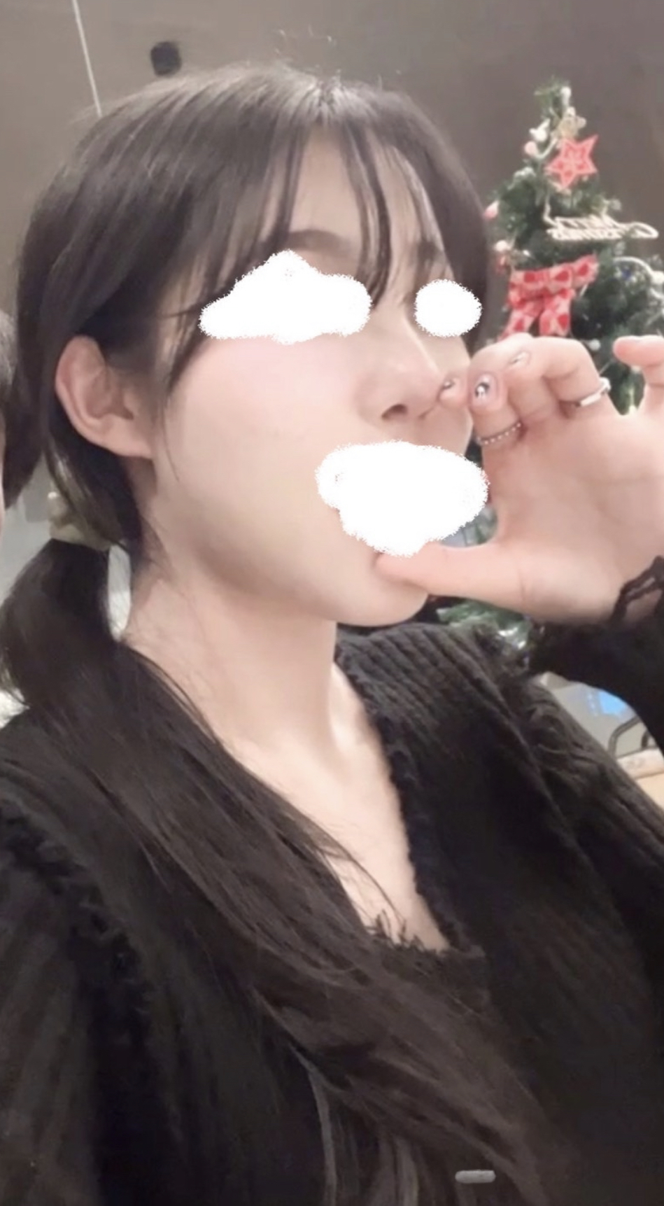 수술후기이미지