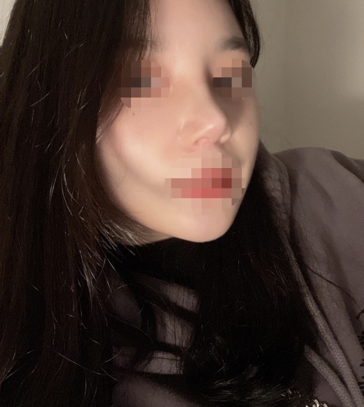 수술후기이미지