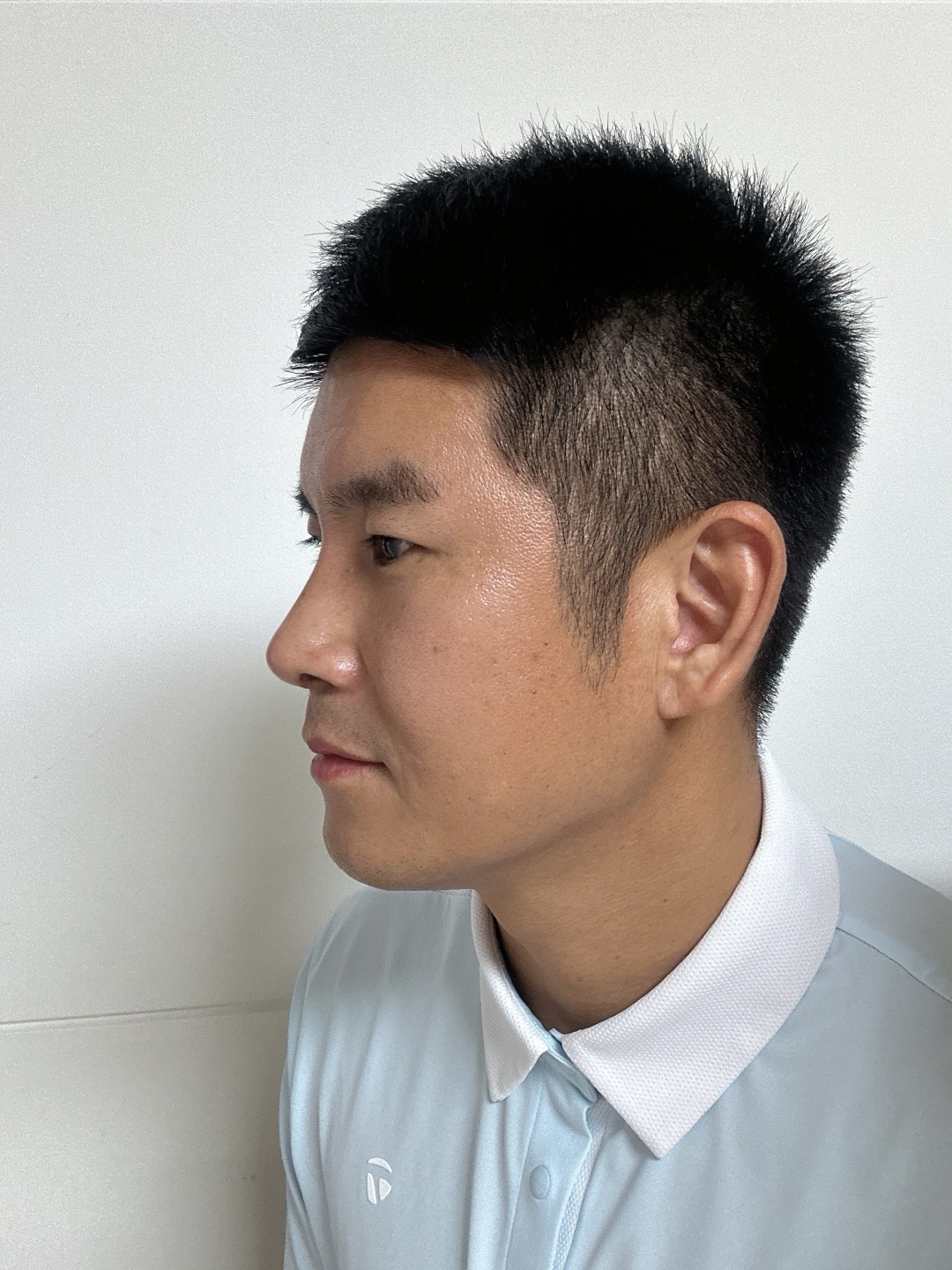 수술후기이미지