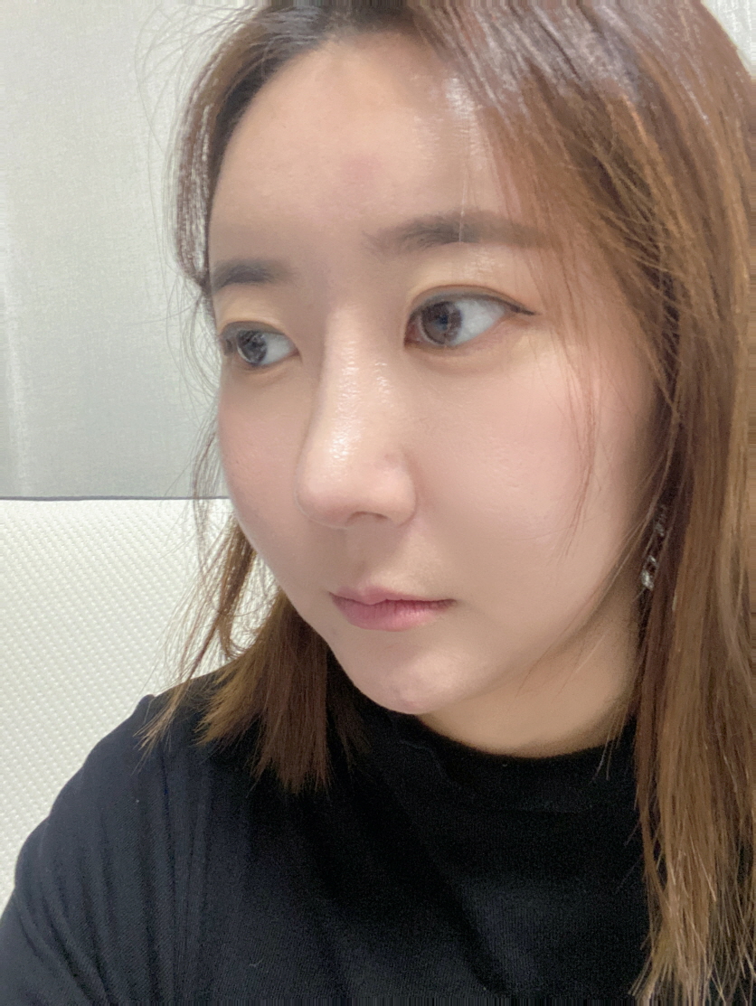 수술후기이미지