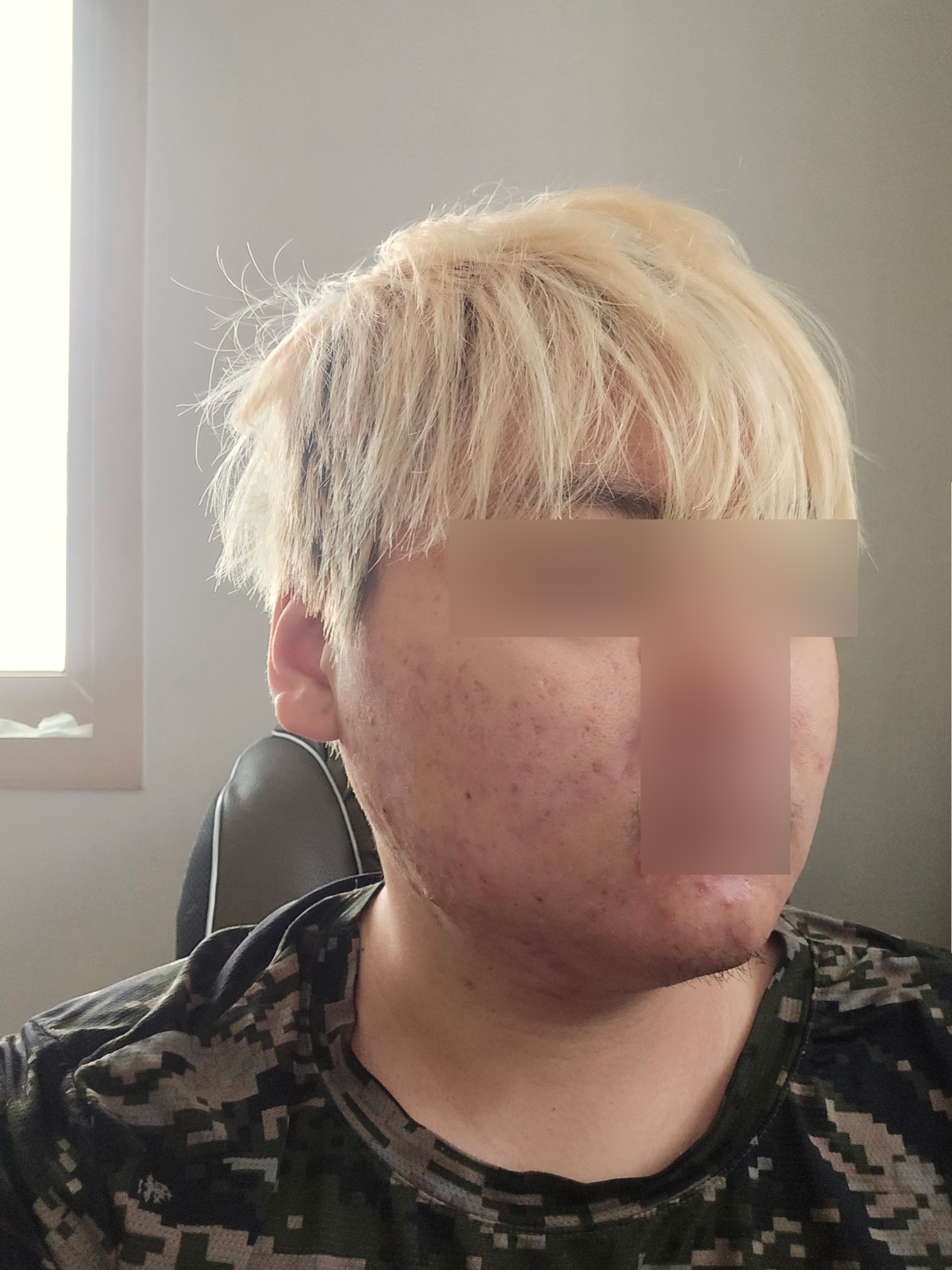 수술후기이미지
