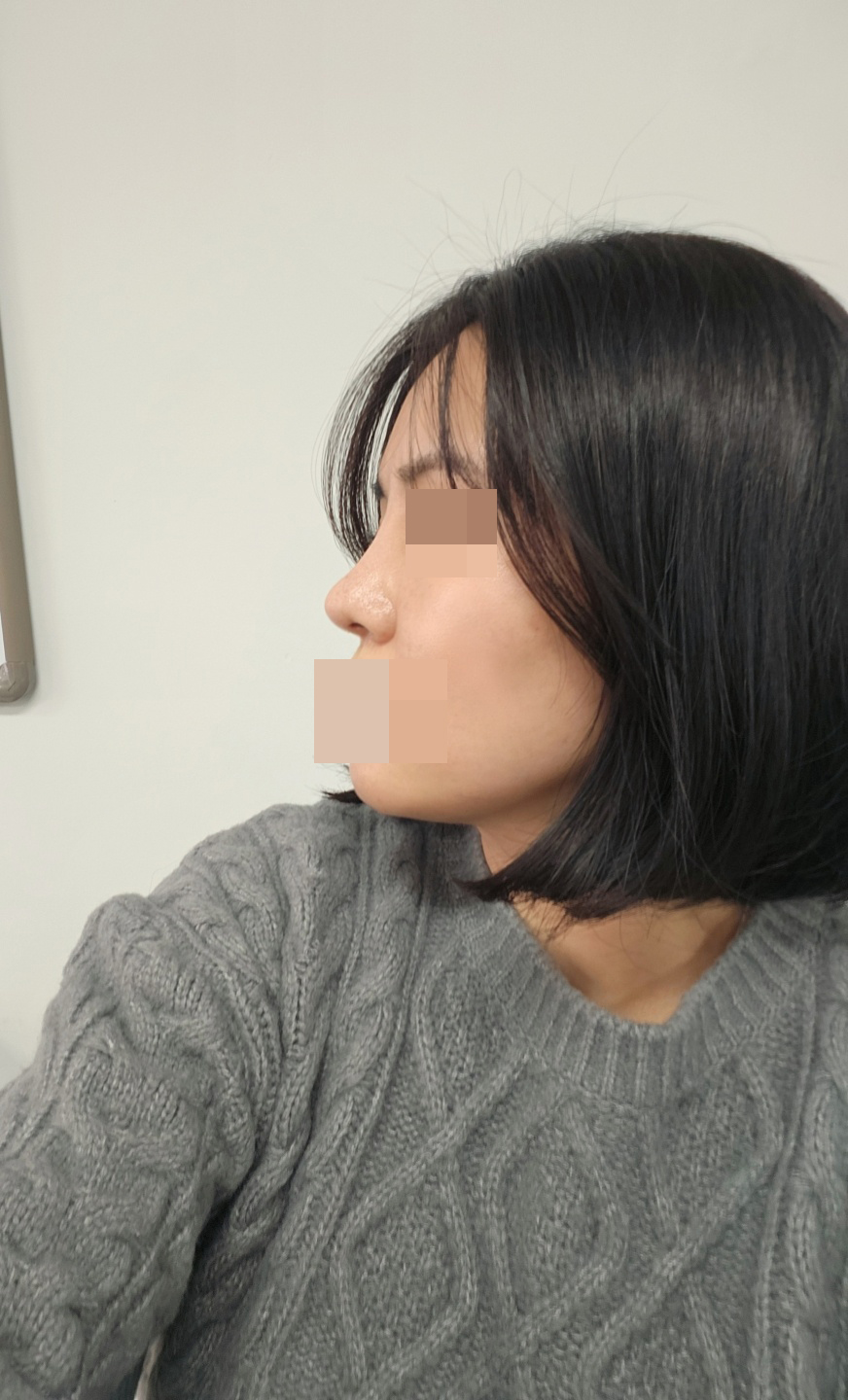 수술후기이미지