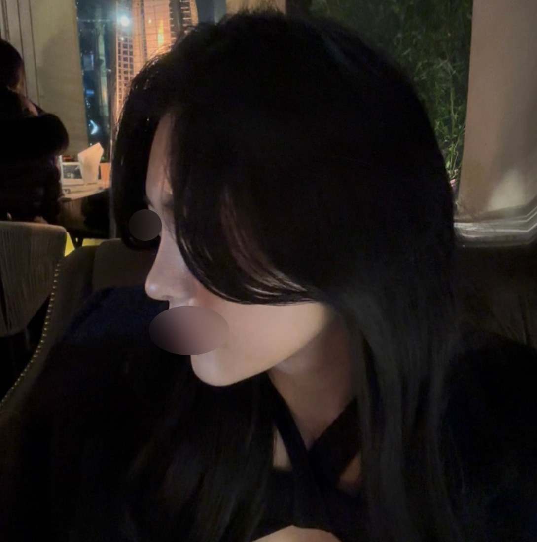 수술후기이미지