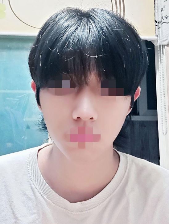 수술후기이미지