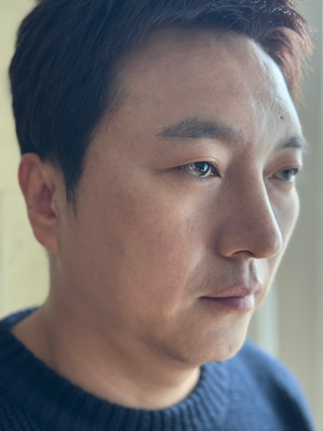 수술후기이미지