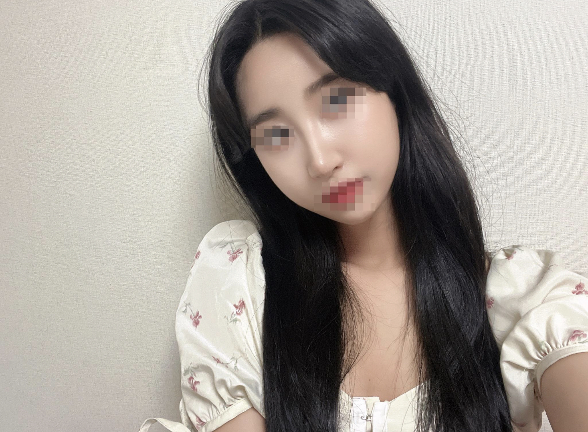 수술후기이미지