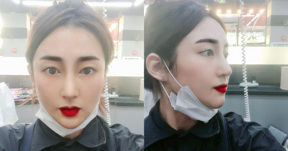 수술후기이미지