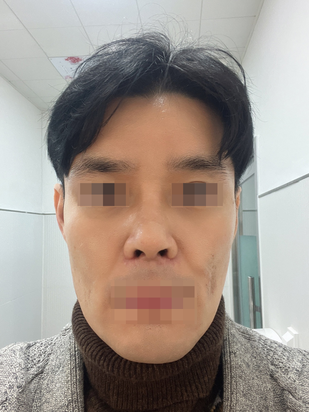 수술후기이미지