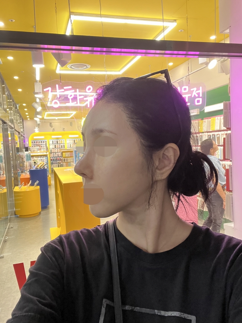 수술후기이미지