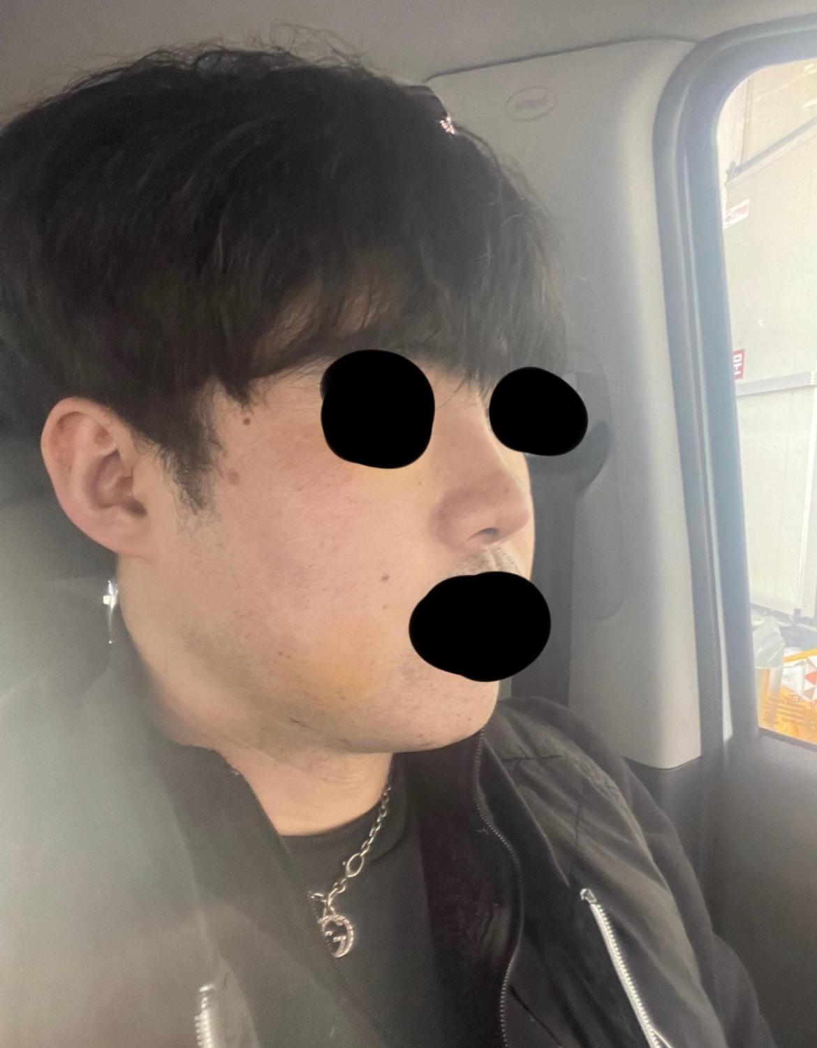 수술후기이미지