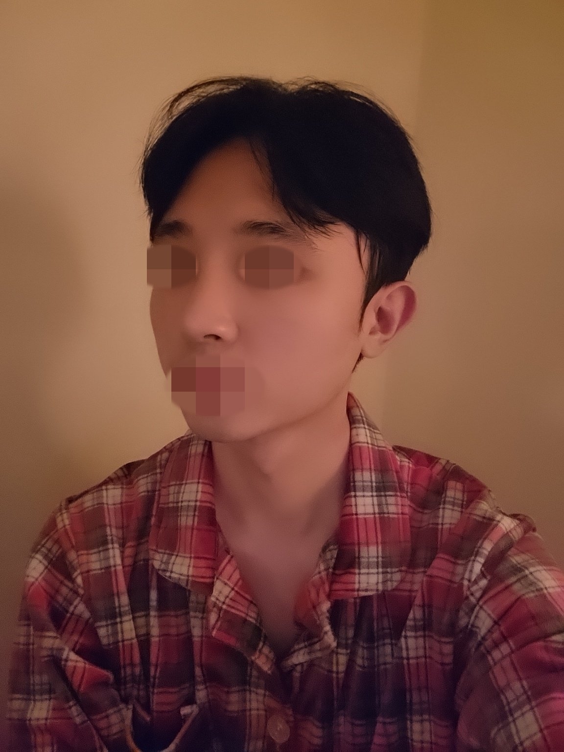 수술후기이미지