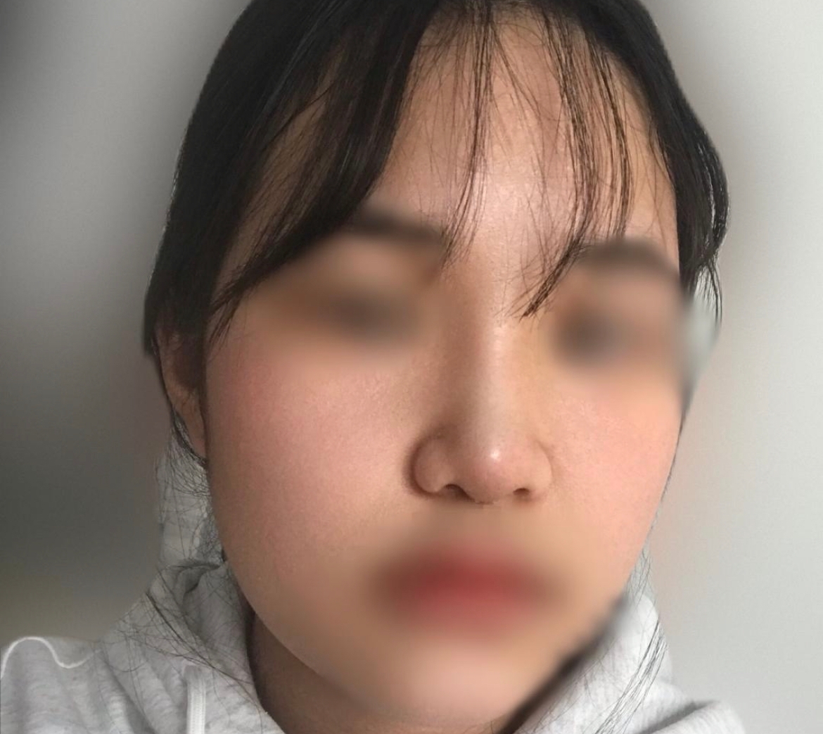 수술후기이미지