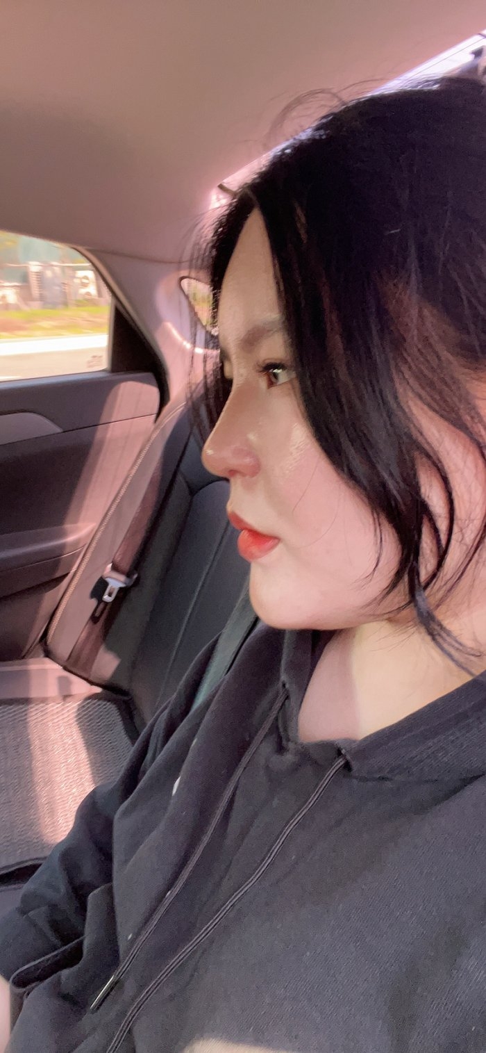 수술후기이미지