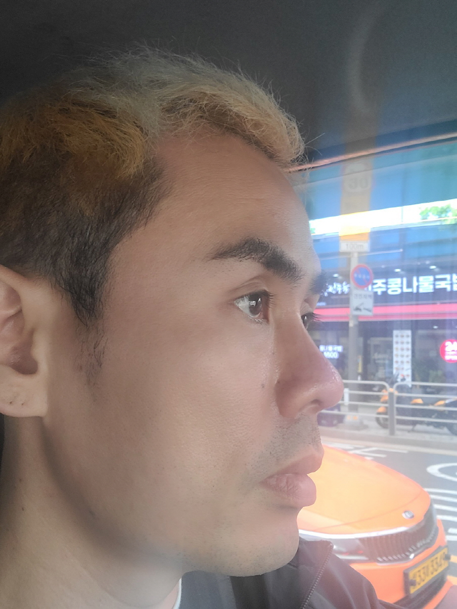 수술후기이미지