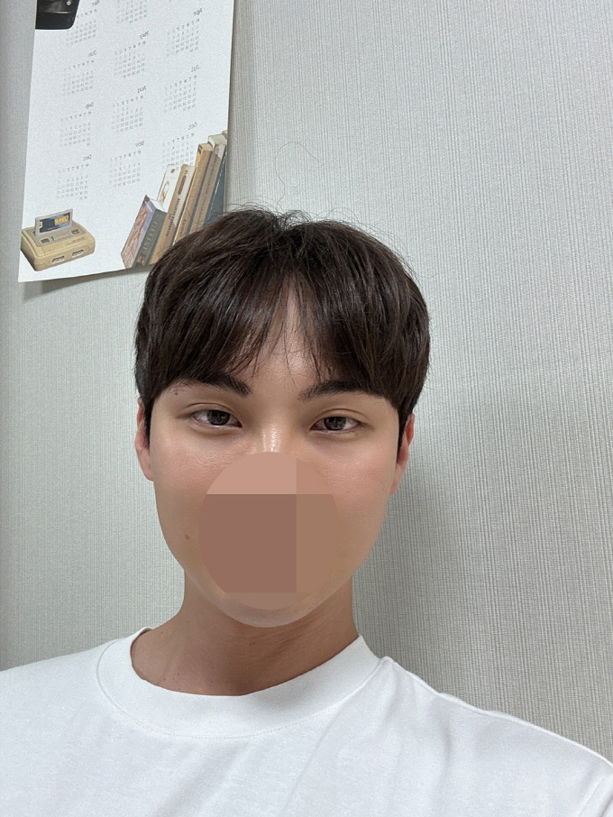 수술후기이미지