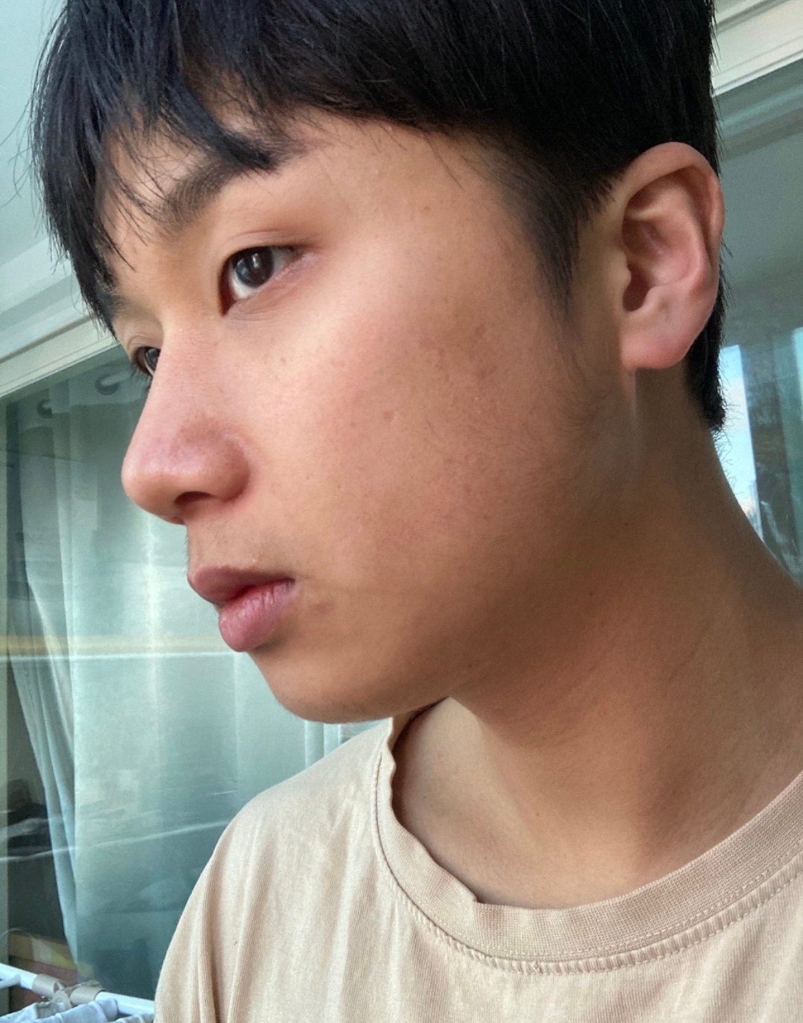 수술후기이미지