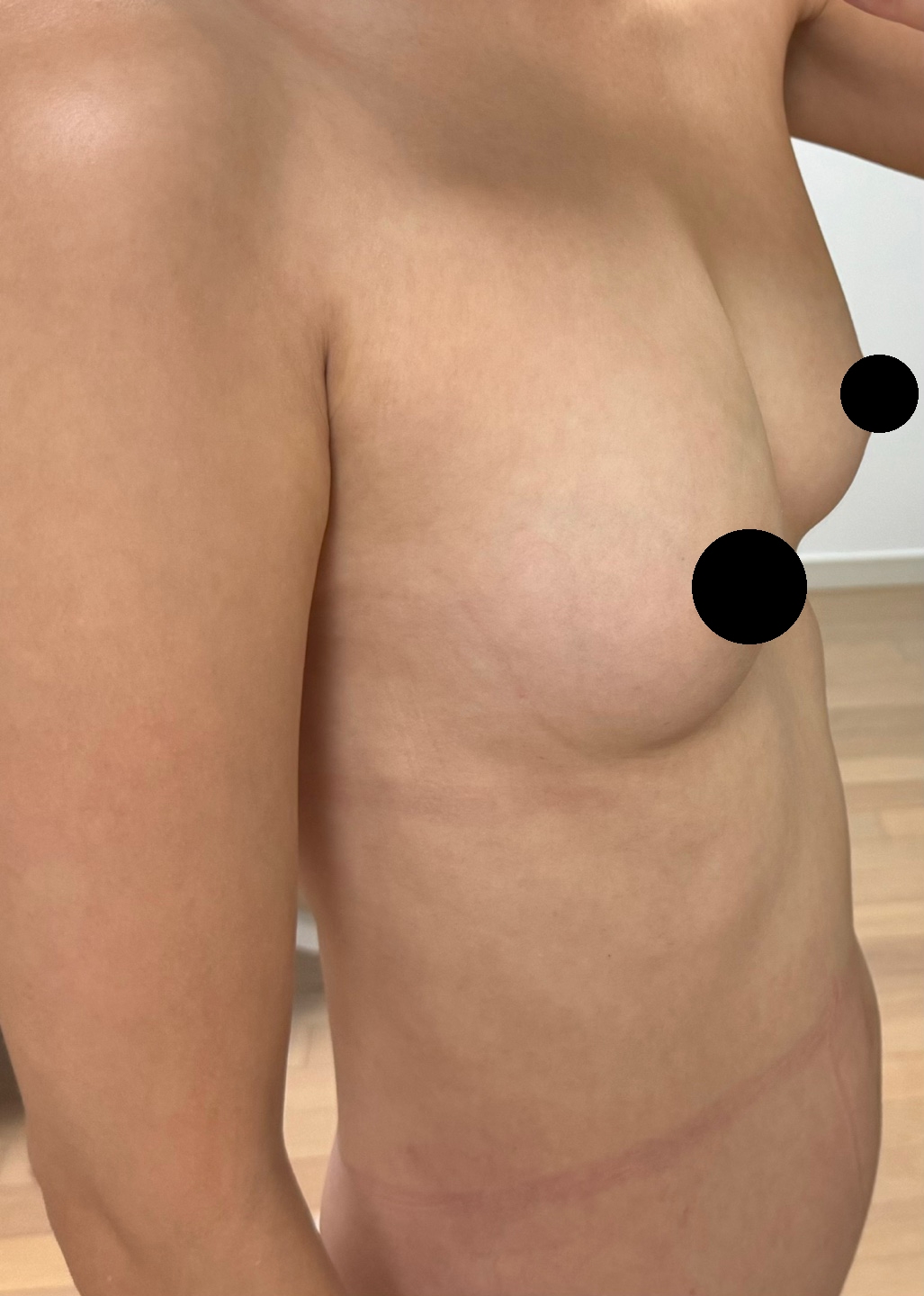 수술후기이미지