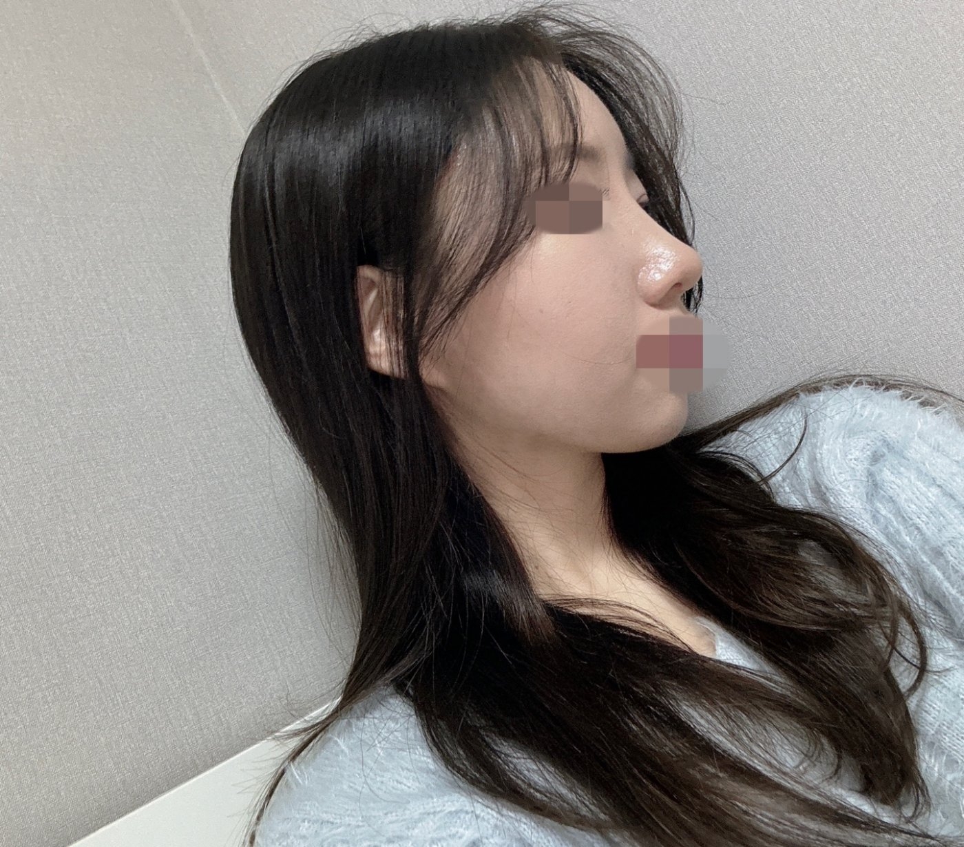 수술후기이미지