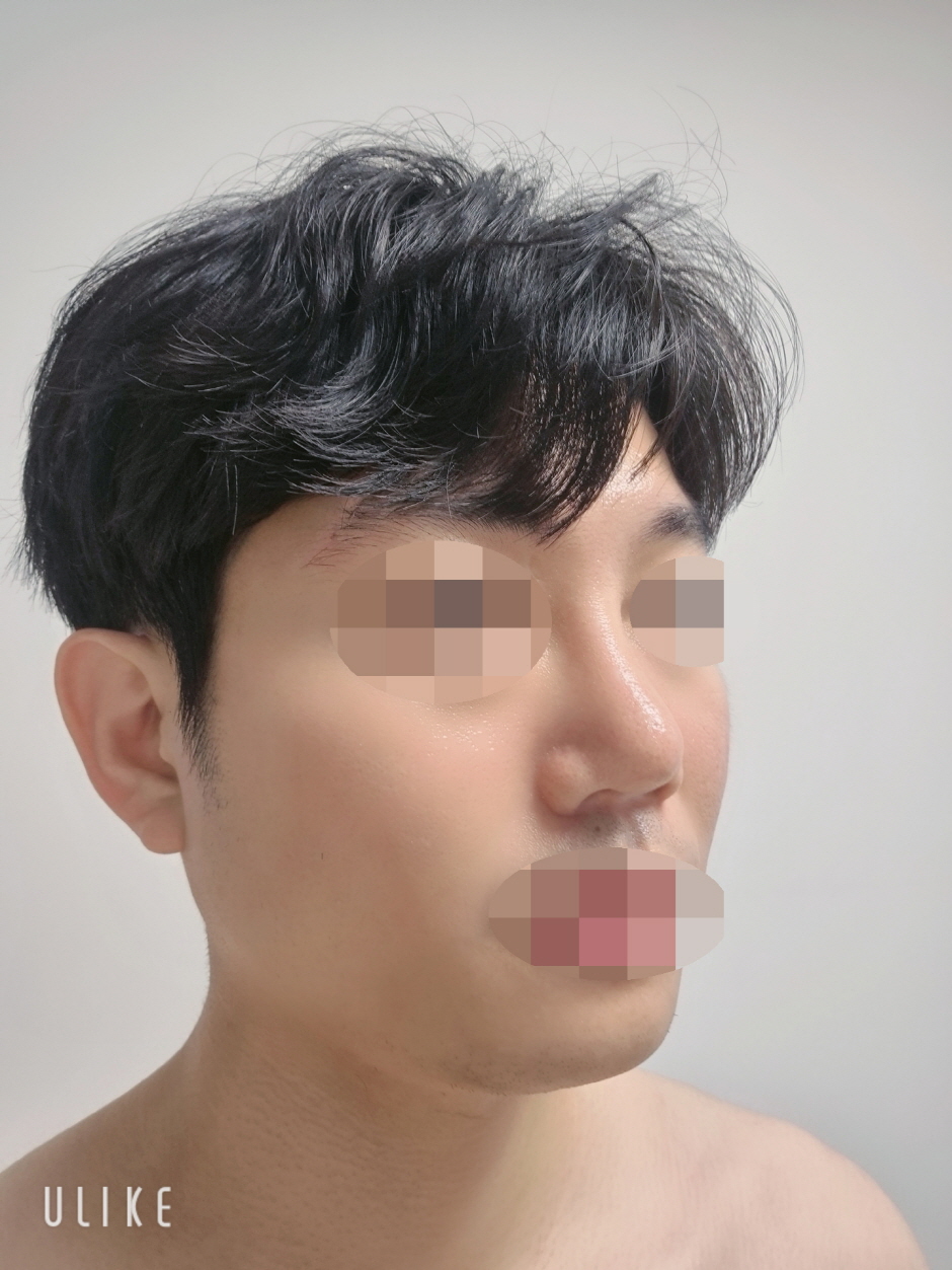 수술후기이미지