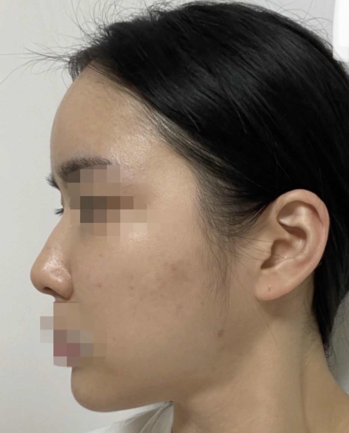 수술후기이미지