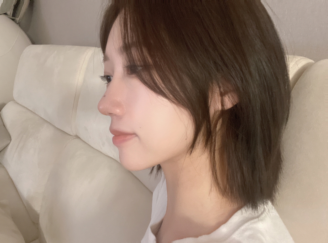 수술후기이미지