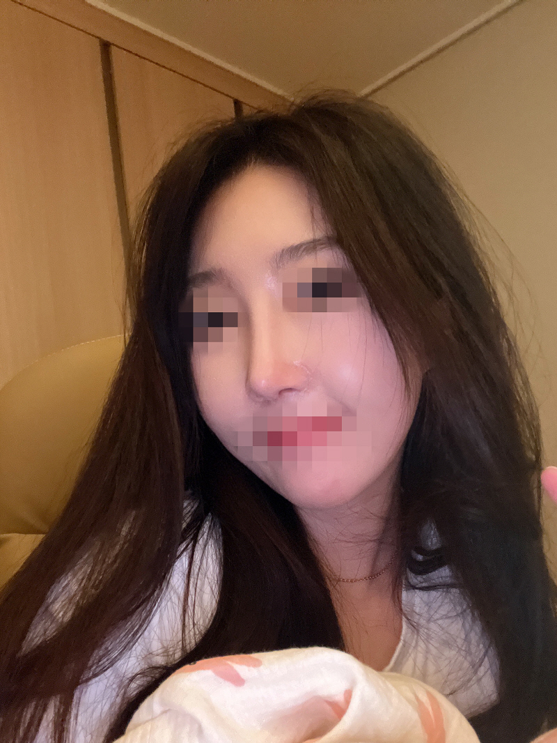 수술후기이미지