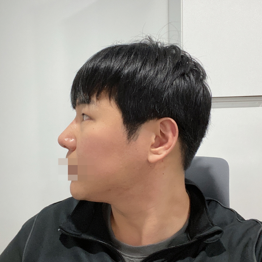 수술후기이미지