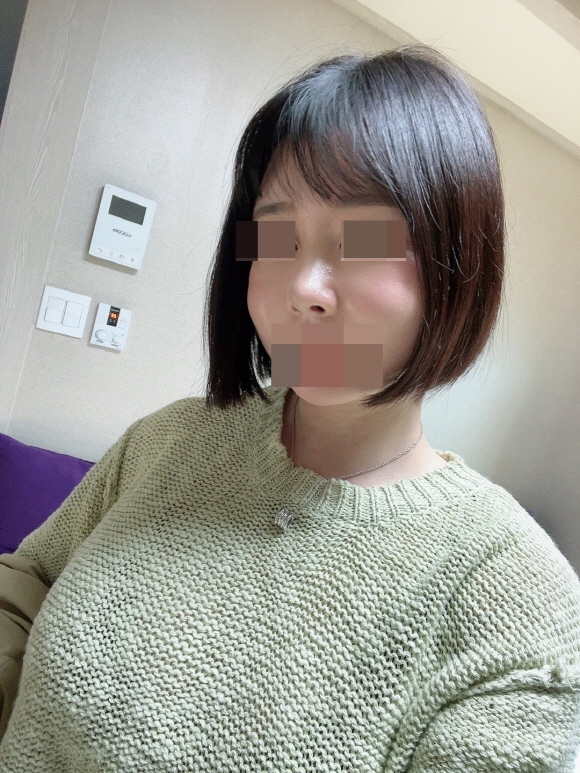 수술후기이미지