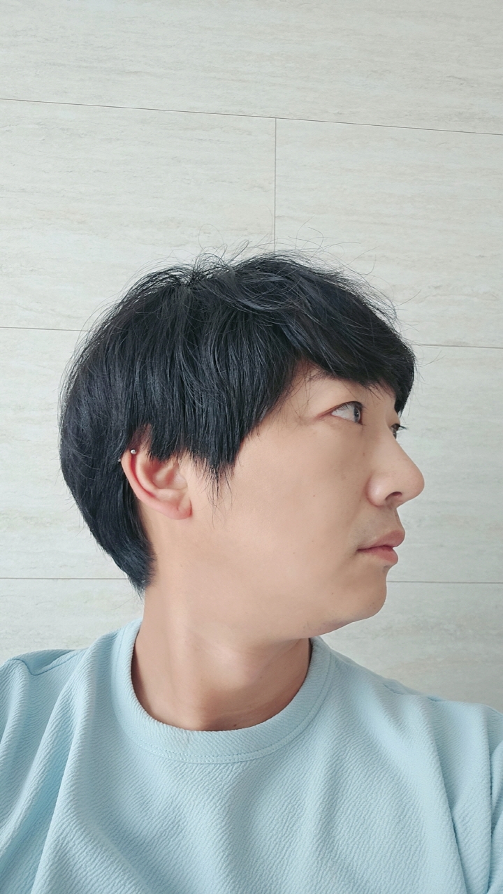 수술후기이미지