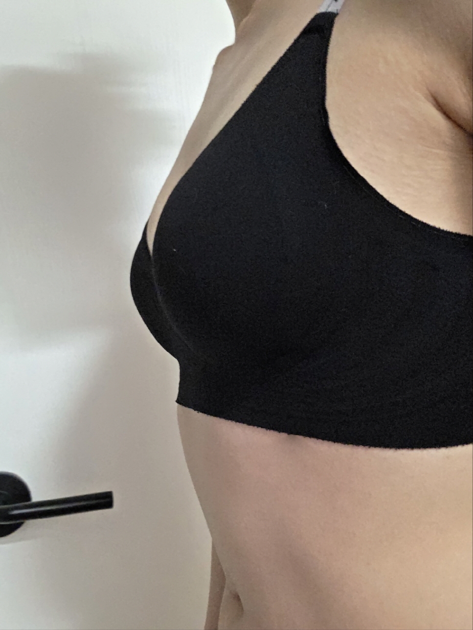 수술후기이미지