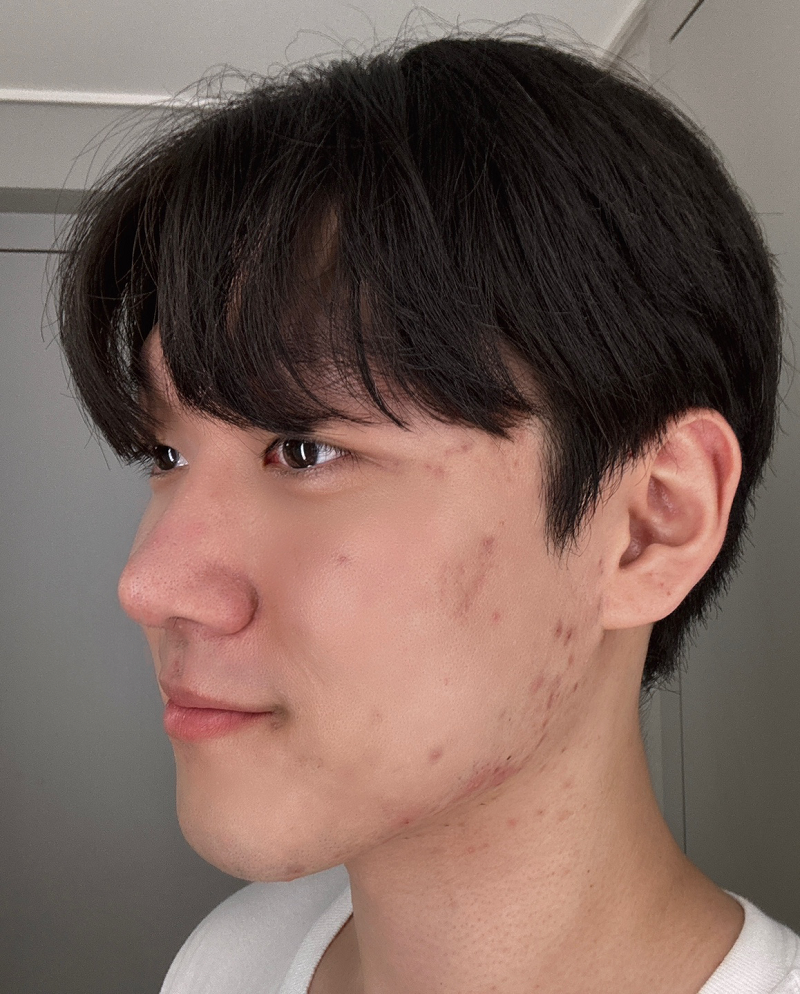 수술후기이미지