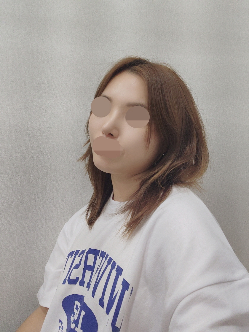 수술후기이미지