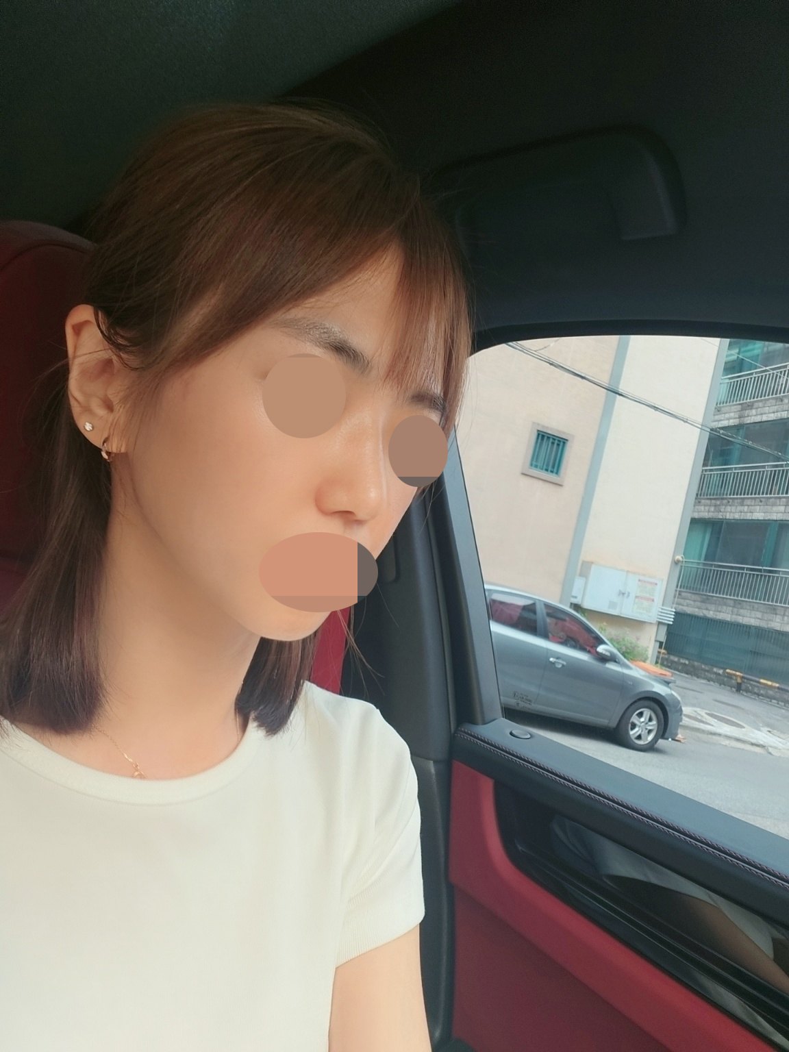 수술후기이미지