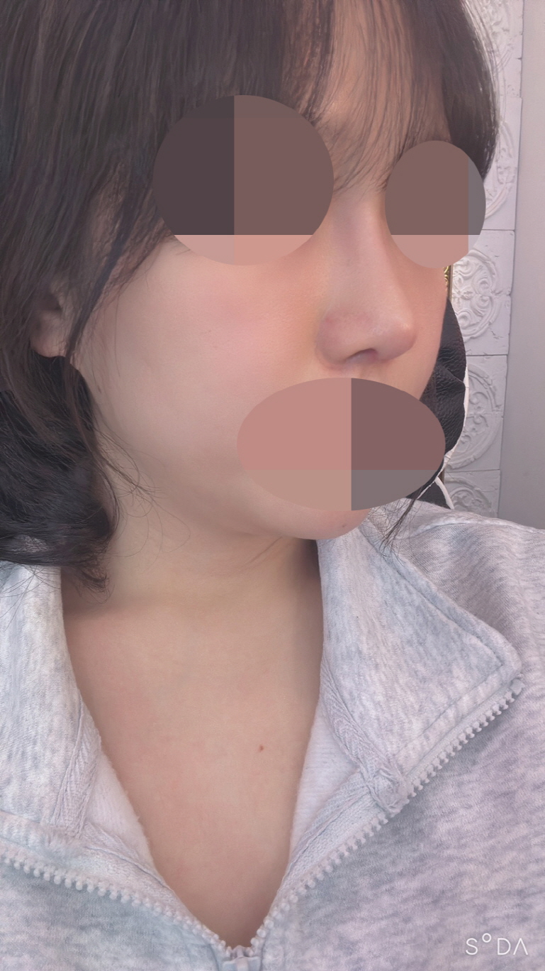 수술후기이미지