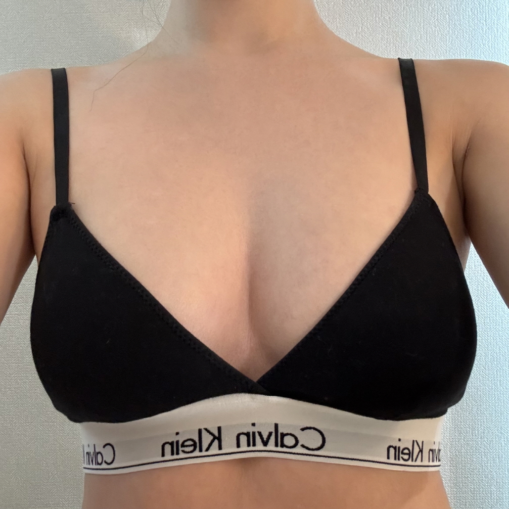 수술후기이미지