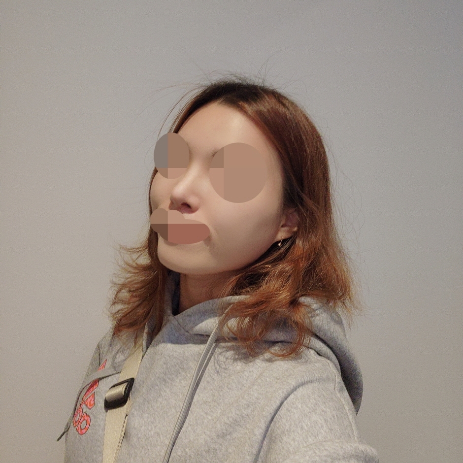 수술후기이미지