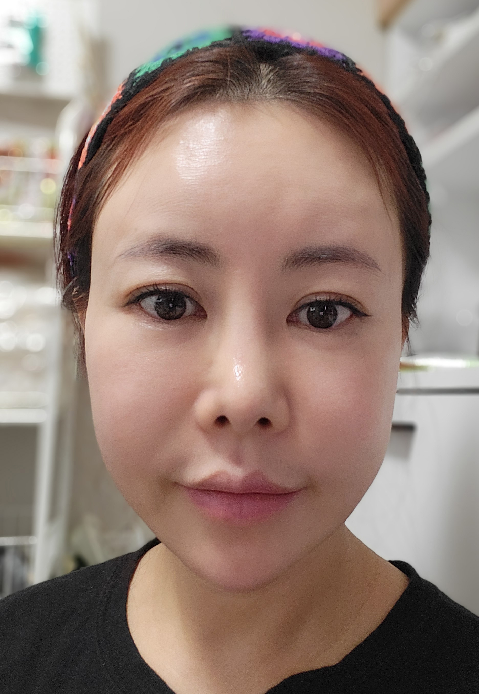 수술후기이미지