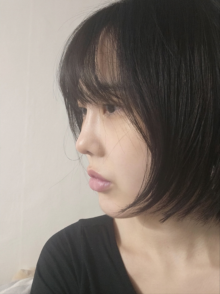 수술후기이미지