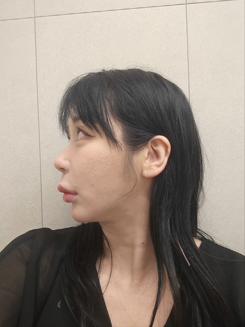 수술후기이미지