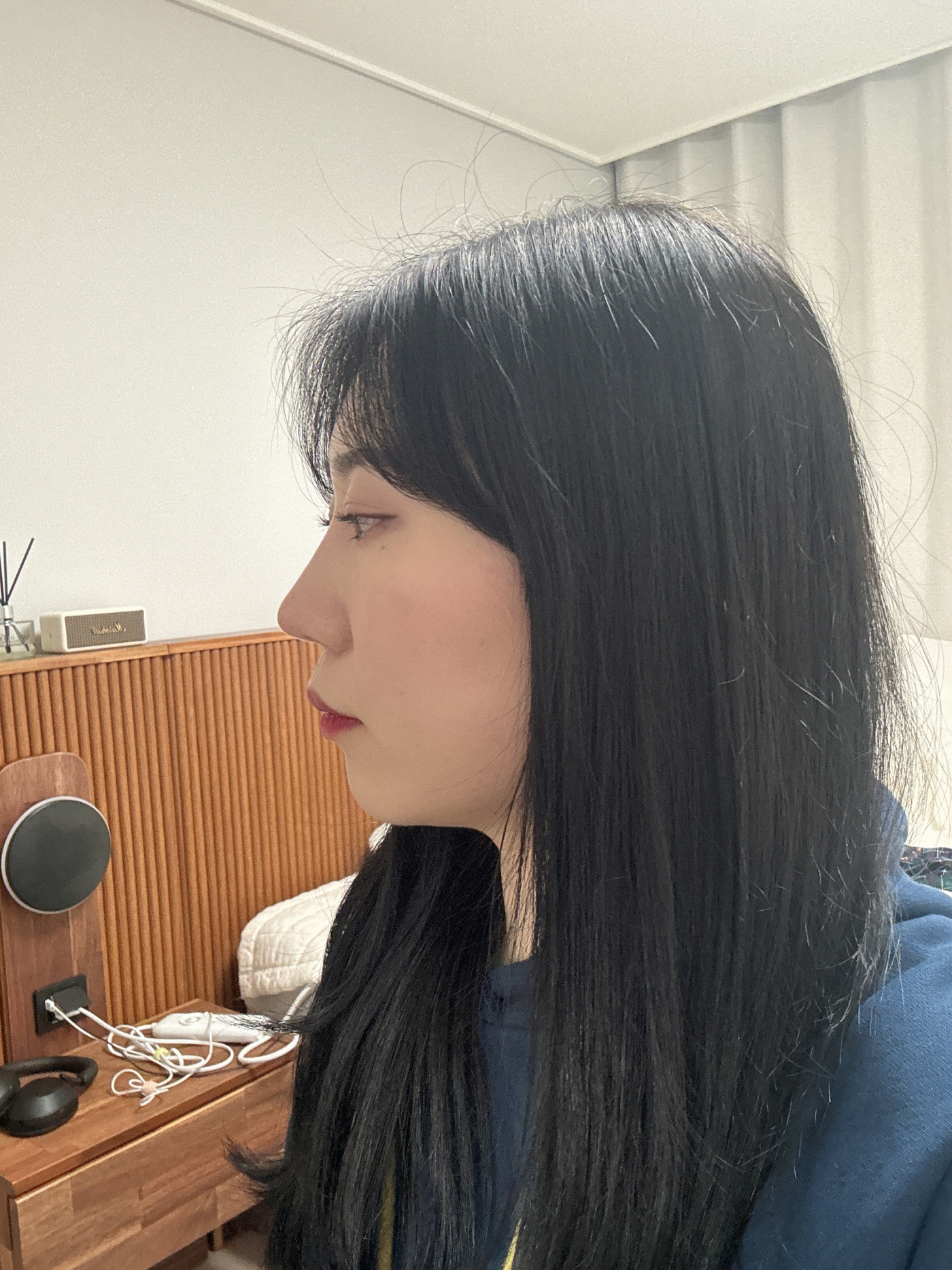 수술후기이미지