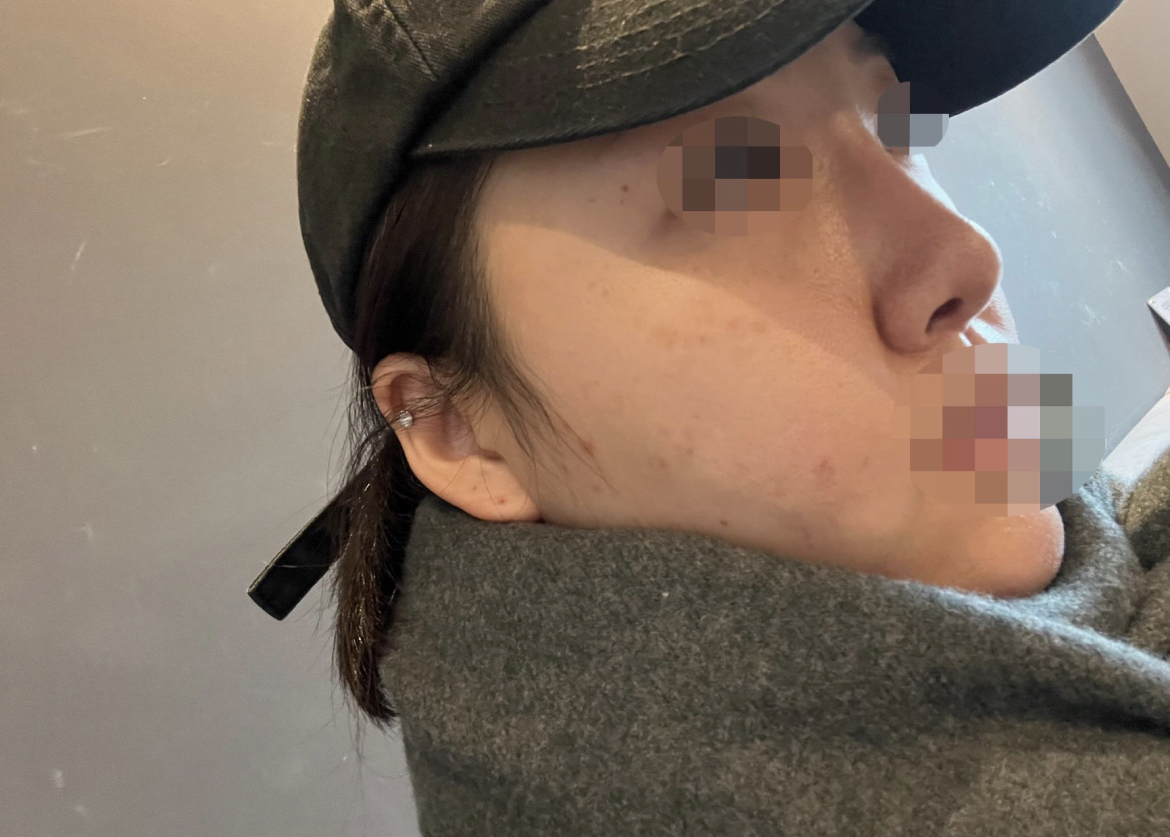 수술후기이미지