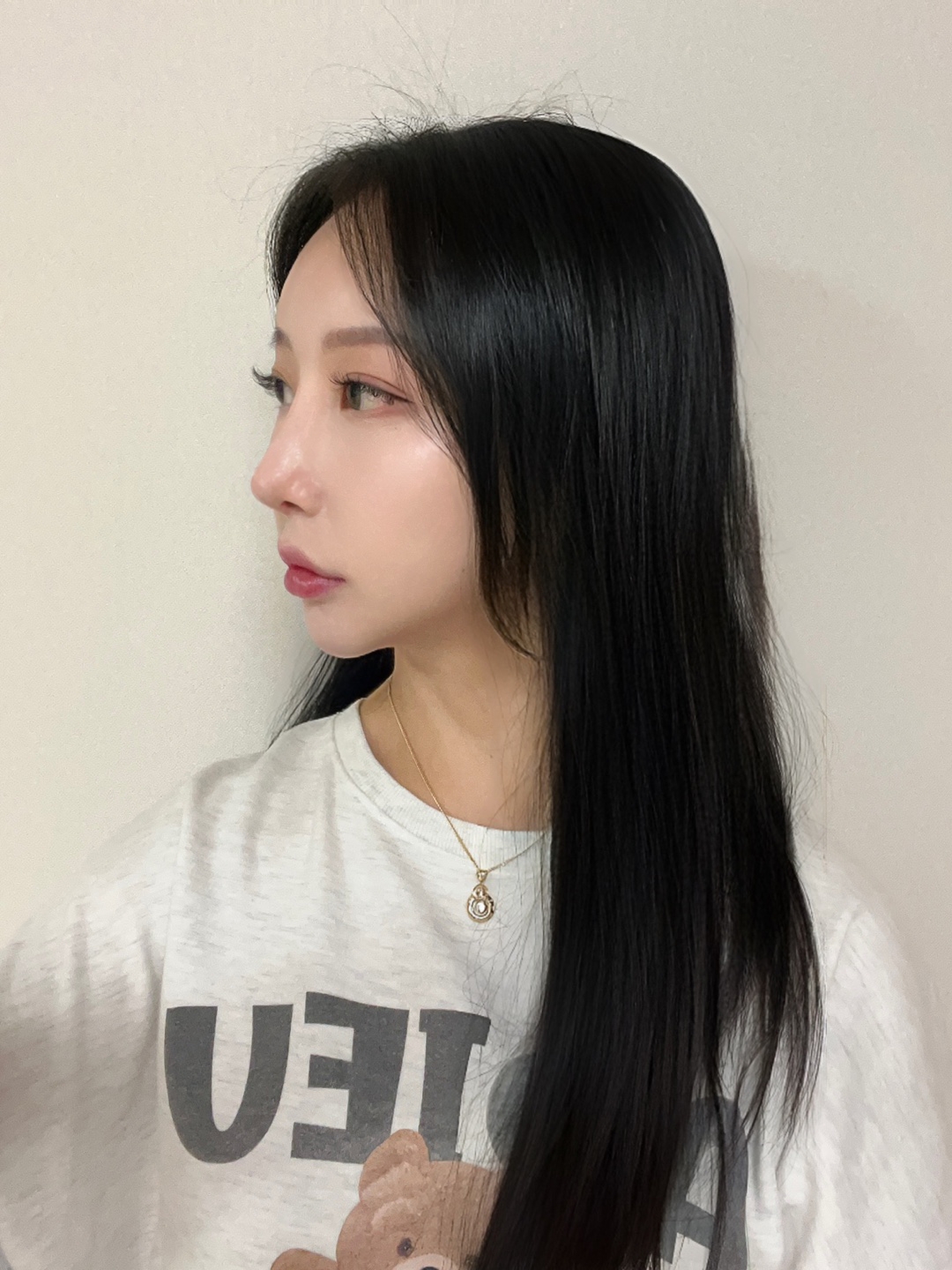 수술후기이미지