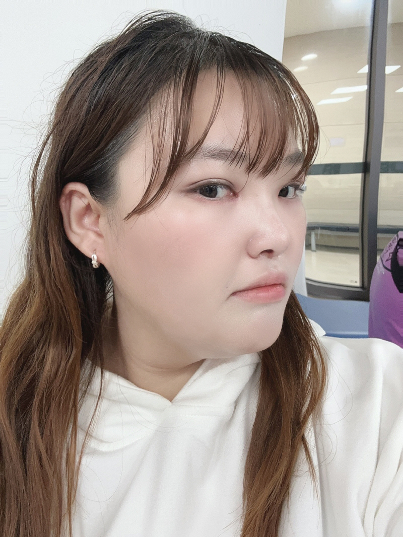 수술후기이미지