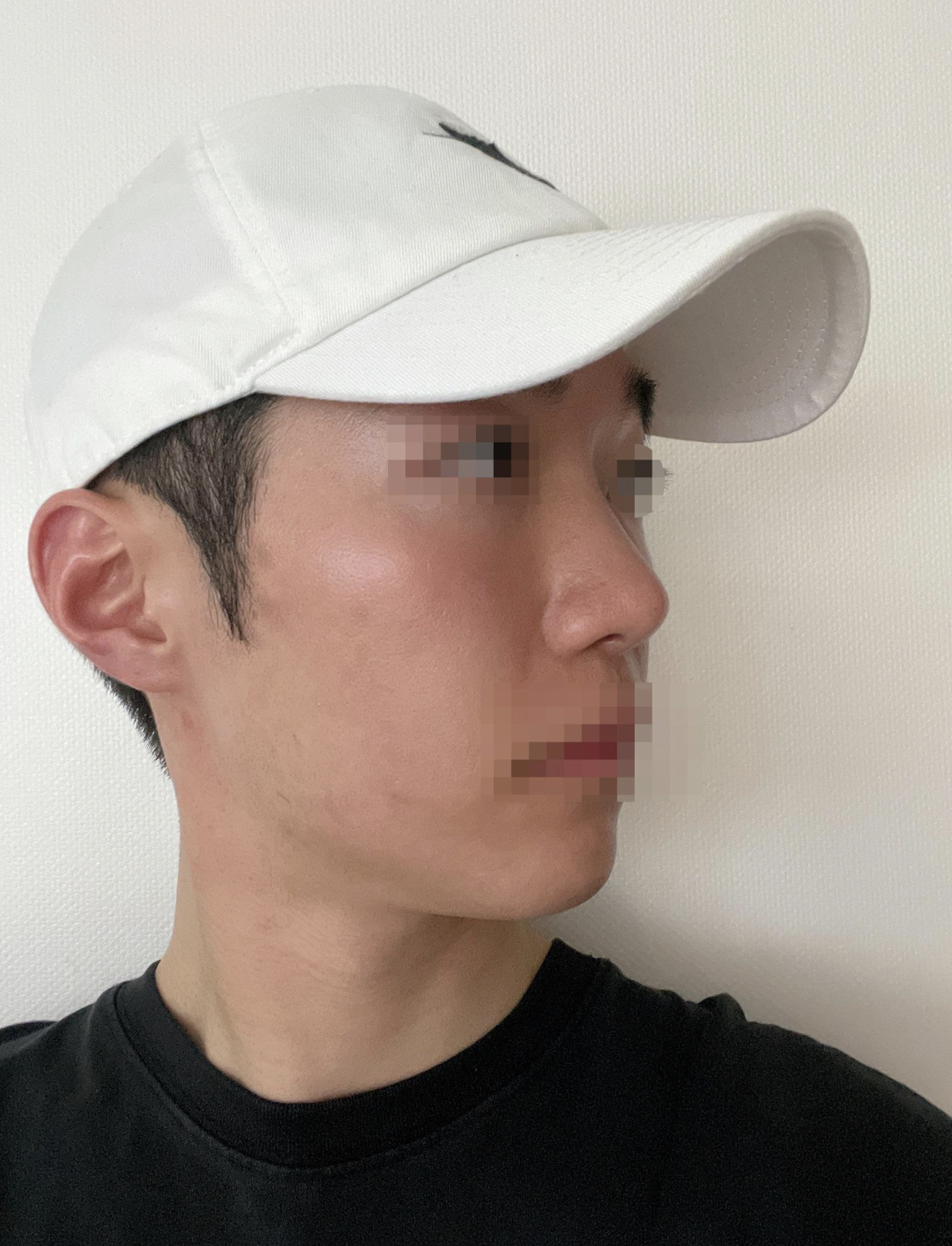 수술후기이미지