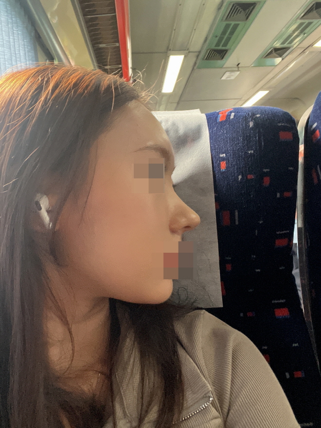 수술후기이미지