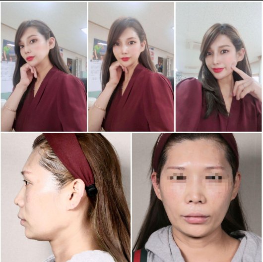 수술후기이미지