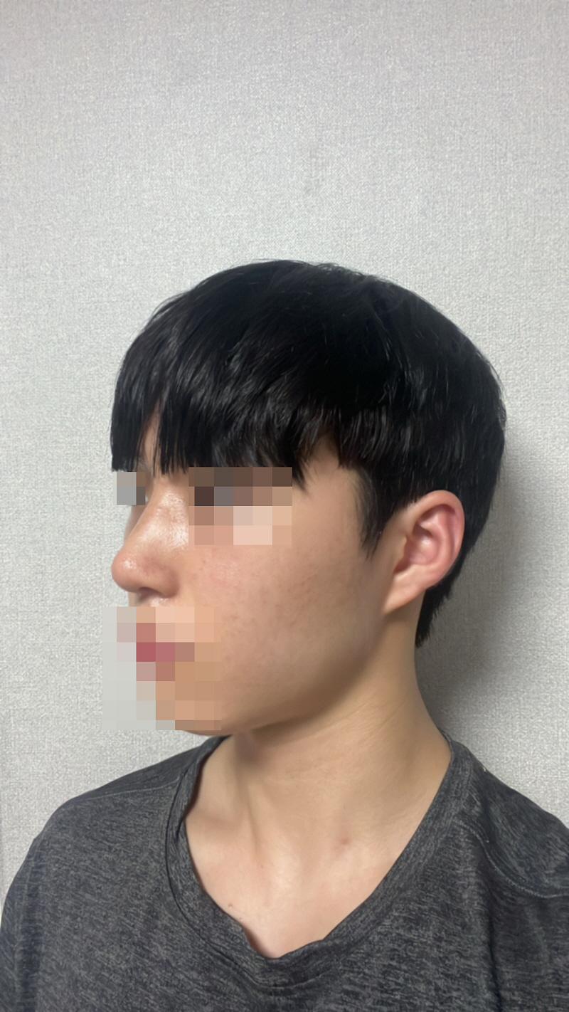 수술후기이미지