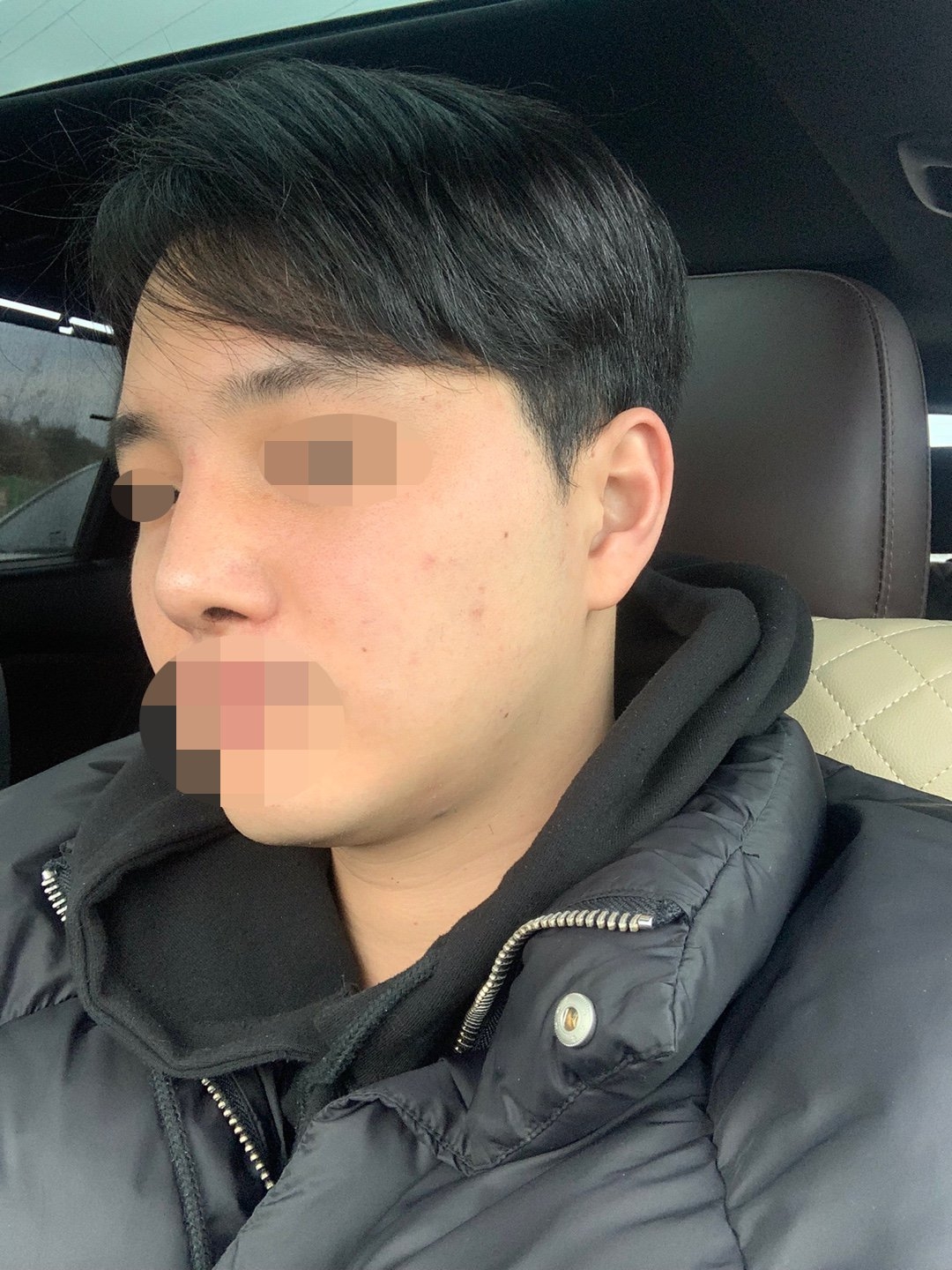 수술후기이미지