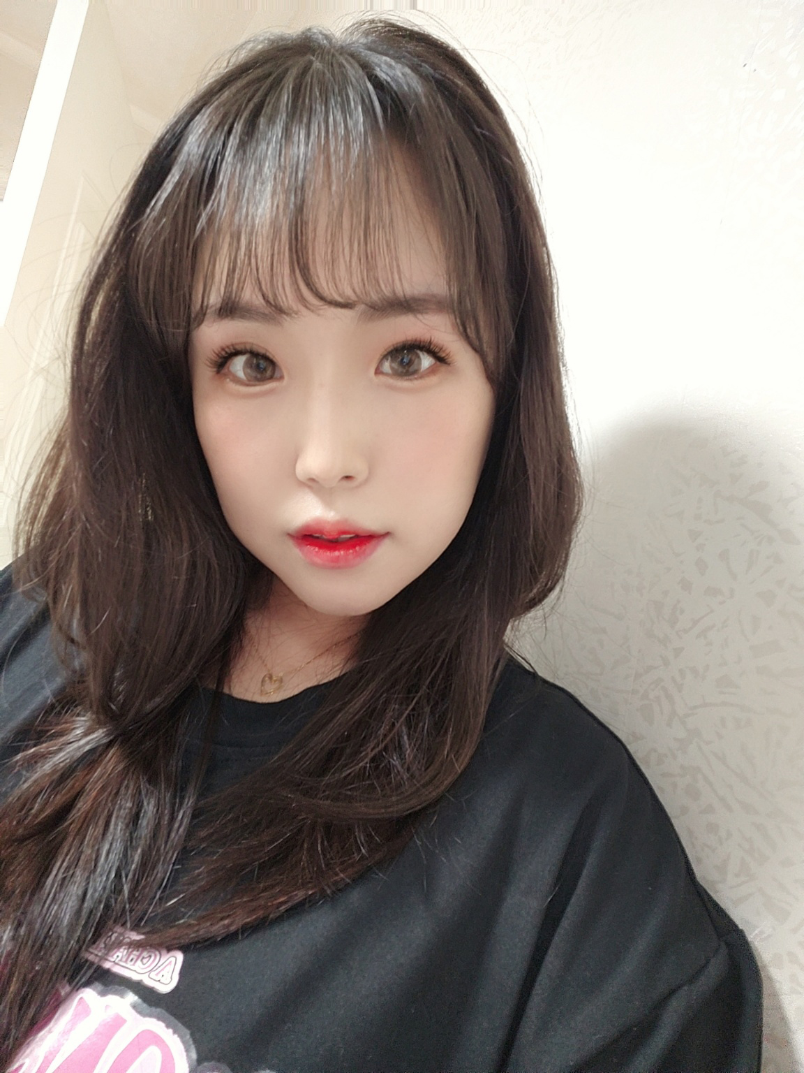 수술후기이미지