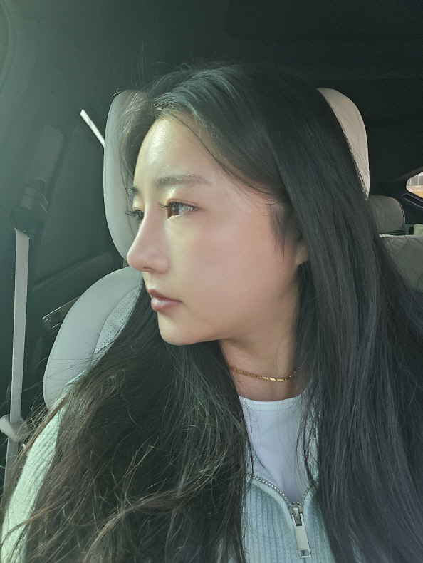 수술후기이미지